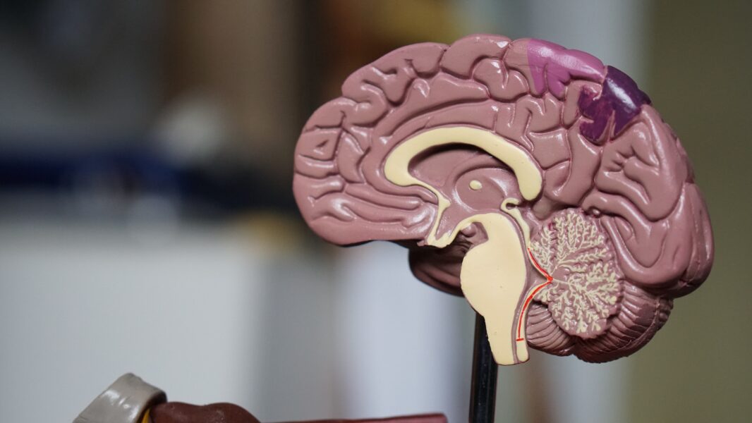 How quickly does dementia progress care business associate training
